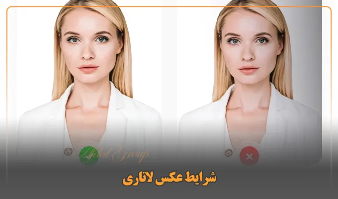 شرایط عکس لاتاری